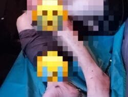 Pergoki Istri Selingkuh, Suami Diseret Mobil hingga Patah Kaki