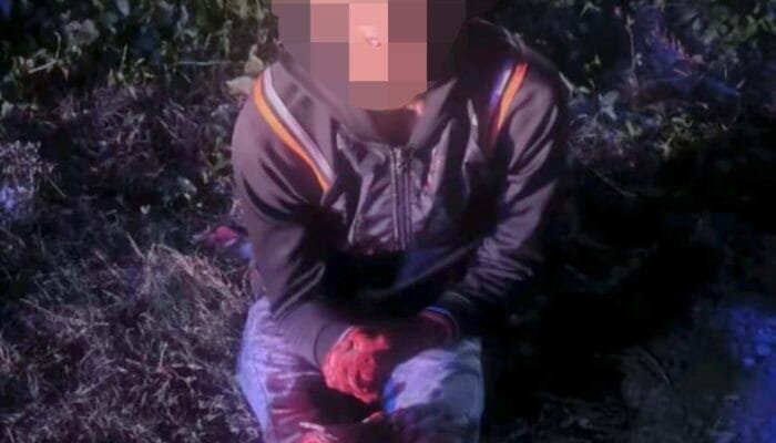 Diduga Ingin Curi Motor dan Tabung Gas, Pria di Kajhu Terluka Saat Melawan Warga